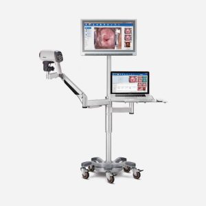 Colposcope vidéo